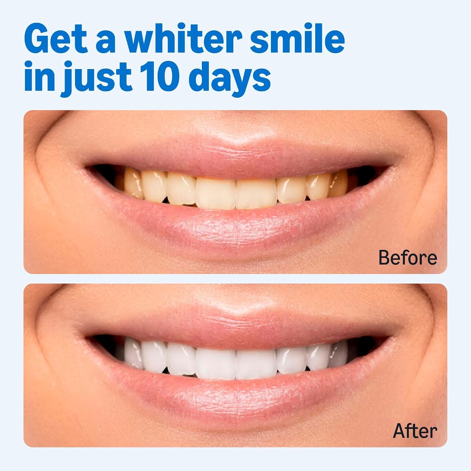 10 Day Teeth Whitening Strips Kit
